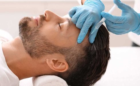 Mésothérapie cheveux à Marseille à la Clinique du Palais